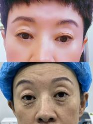 体验后-烟台曙光医疗美容医院