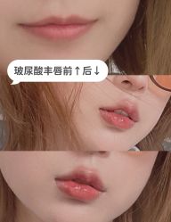 -上海漾颜医疗美容