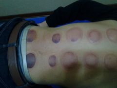 -中医推拿(永兴佳园店)