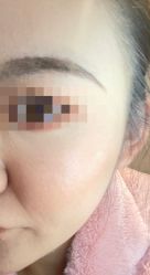 -Yestar艺星医疗美容医院