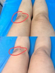 -More摩尔医美の注射线雕光电中心