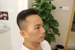 -大麦微针植发丨全国连锁