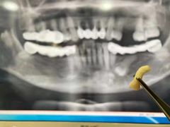 -牙易美口腔(圣堂店)