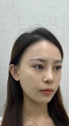 -深圳艺星医疗美容医院