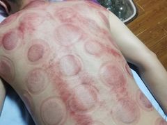 -沈师傅盲人按摩工作室(密三小区店)