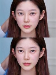 -广州美莱医疗美容医院