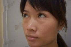 -天津健丽·去眼袋医疗美容机构