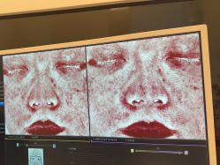 -苑苑vbeauty科技美容SPA