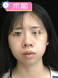 -素美医疗美容·西南眼鼻整形·修复基地