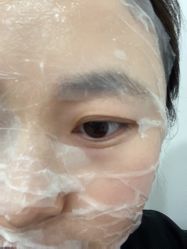 体验前-西安壹加壹医疗美容·西北抗衰旗舰店
