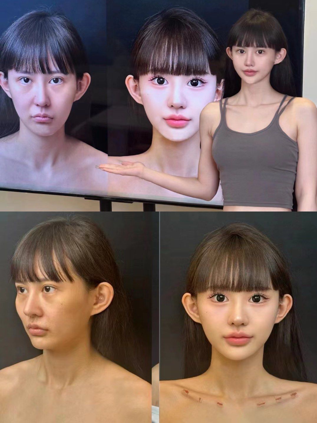 幼态脸30天效果分析