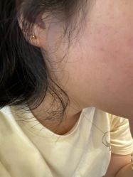 -美瑞莎创美医疗美容