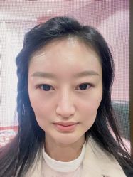 体验后-北京炫美医疗美容