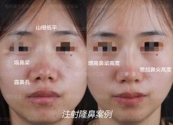 -北京米扬丽格医疗美容·联合丽格鼻整形中心