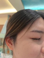 -长沙雅美医疗美容医院