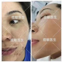 点击看大图 -痘敏医生专业祛痘·肌肤修复连锁