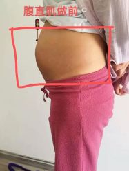-兰州舒馨精致月子中心