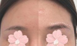 -郡艺医疗美容·微整·眼鼻吸脂