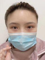 -素美医疗美容·西南眼鼻整形·修复基地