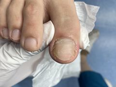-Andrew指甲专科灰指甲·甲沟炎矫正·3D步态矫形鞋垫定制(上海法华镇路旗舰店)