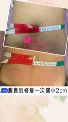 -阖美.纤思韵产后养护中心(长沙店)