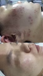-康美贞·痘肌养护管理中心