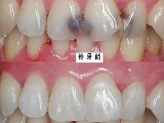 -团圆口腔·种植中心(锦江院区)
