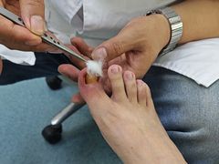 -新甲连锁灰指甲·甲沟炎·鸡眼(黑龙江路店)