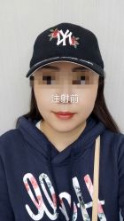 -More摩尔医美の注射线雕光电中心