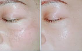 点击看大图 -SKINIST丽铂医疗美容