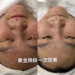 -凡碧诗毛孔收细