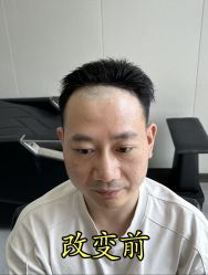 -唐风采假发补发定制