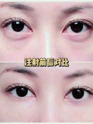 -上海漾颜医疗美容
