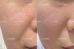 -武汉五洲整形外科医院