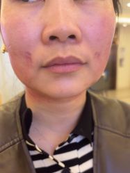 -长沙雅美医疗美容医院