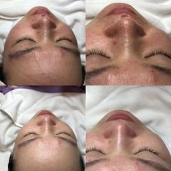 -悦肌YJ FOR FACE皮肤管理中心