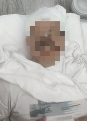 -元熙兰积皮肤管理