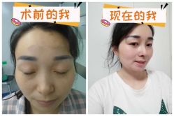 -素美医疗美容·西南眼鼻整形·修复基地