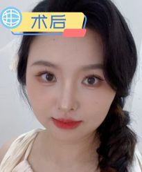 -素美医疗美容·西南眼鼻整形·修复基地