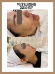 -美肤盾祛痘·问题肌头疗管理中心