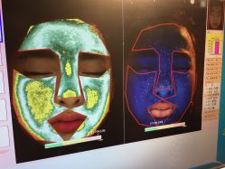 点击看大图 皮肤诊断-光SPA科技美肤