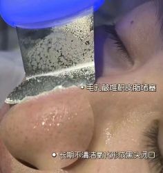 -MLP美丽派·问题肌疗愈中心