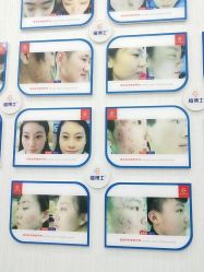 -悟空祛痘·诺奖技术专业店