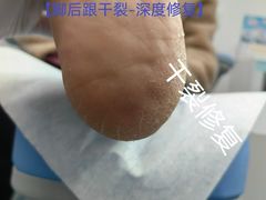 -Andrew指甲专科灰指甲·甲沟炎矫正·3D步态矫形鞋垫定制(浦三路店)