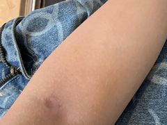 -成都市第一人民医院(南区)