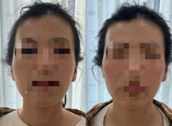-颜和骨正·明哲式骨相美学整骨