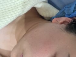 -四川米兰柏羽医学美容医院