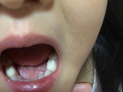 -极橙儿童齿科矫正中心(奥城店)