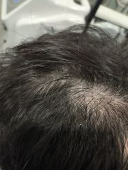 -熙朵美学植发·连锁品牌