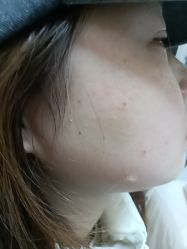 -长沙雅美医疗美容医院